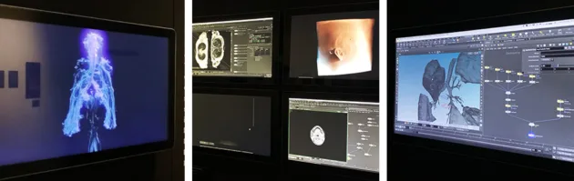 Three images side by side. The first is a medical scan of someone's body. The second has several scans, which appear to be CT scans. The third is an image on a computer monitor, showing how scanned data is used to create sci-art installations.